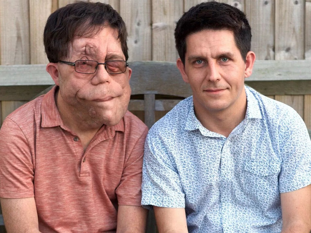 Adam Pearson And Neil Pearson Age Gap
