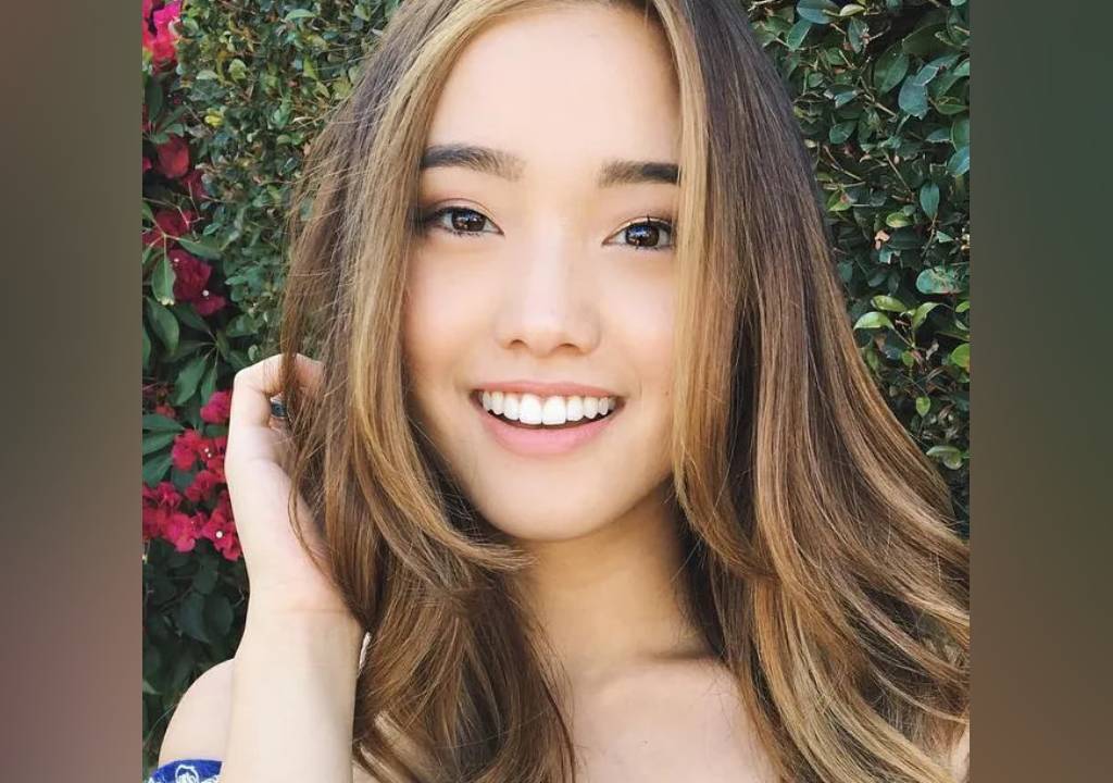 Jenn Im Teeth Accident