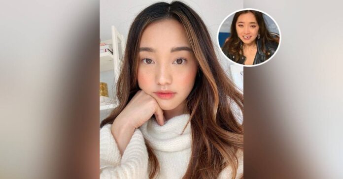 Jenn Im Teeth Accident