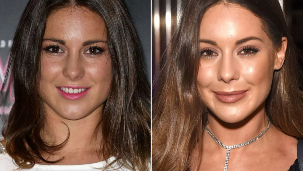 Louise Thompson Weight Loss
